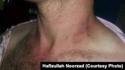 ارشیف: د طالبانو له‌خوا یو ربړول شوی افغان ژورنالیست