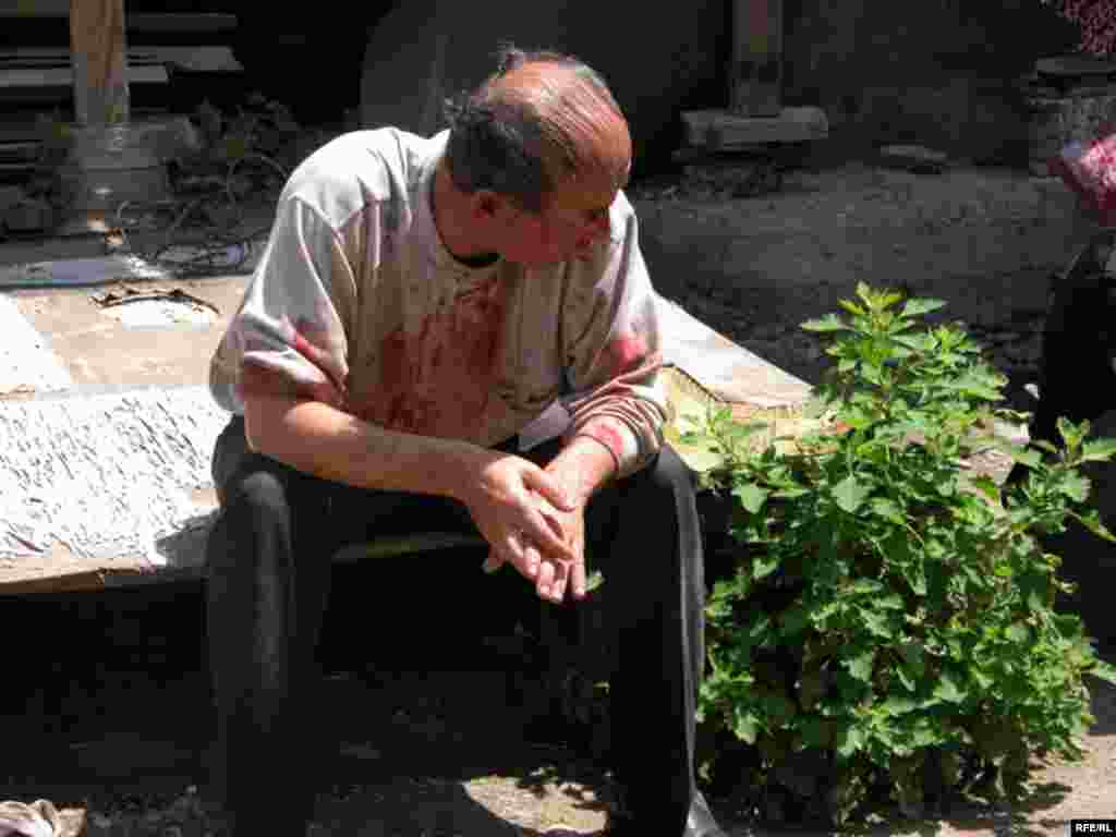 Ўш¸ 11 июн¸ 2010 йил - Ўшда яраланганлардан бири.