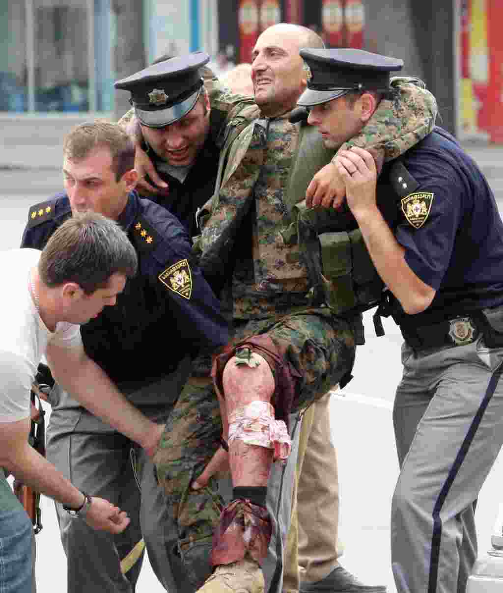 Співробітники поліції допомагають грузинському солдату, який був поранений у боях із російсько-осетинськими силами в місті Ґорі (Фото AFP)