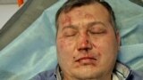 Russia - Kyrgyz taxi driver beaten by passengers - cover
