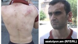 Ակտիվիստ Անդրանիկ Ասլանյանը