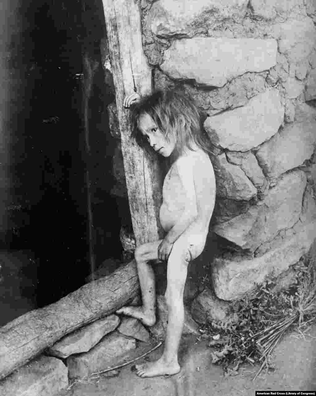 Голодающая 7-летняя девочка в Самарской области в 1921 году. Гражданская война заканчивалась, но экономика страны рухнула, урожая не было и из-за военных действий, и из-за засухи. А из-за политики "военного коммунизма", которая разрешала насильственное изъятие зерна у крестьян, миллионы были охвачены голодом